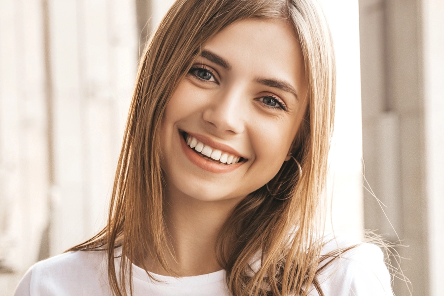 Composite bonding treatment single-session smile enhancement at Sundent Dental Clinic Antalya